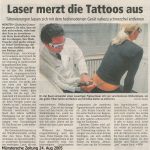 Tattoo Entfernung Dr. Kai Rezai Münster