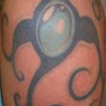 Tattoo Entfernung