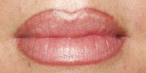 Permanent Make-UP Entfernung Praxis Dr. Kai Rezai